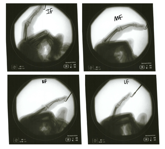 Intra-op Imaging